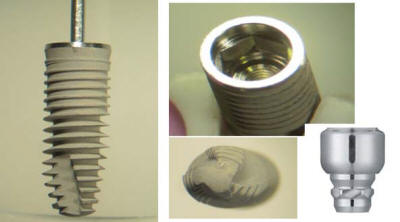 Impianti dentali - Implantologia dentale - Fornitura impianti dentali - vendita impianti dentali - implantologia - implantology